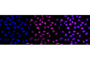 Immunocytochemical staining of HepG2 cells with SF3B1 antibody (ABIN7800424), 1:1,000). (Recombinant Splicing Factor 3B (Subunit 1) 抗体)