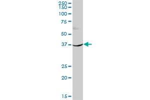 HSD11B2 MaxPab polyclonal antibody. (HSD11B2 抗体  (AA 1-405))