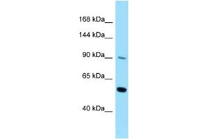WB Suggested Anti-CSF2RB Antibody Titration: 1. (CD131 抗体  (C-Term))