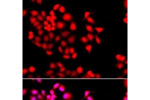 Immunofluorescence analysis of A549 cells using STXBP2 Polyclonal Antibody (STXBP2 抗体)