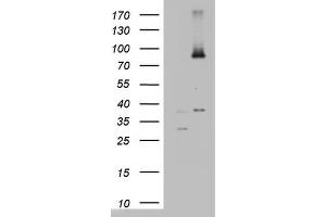 Western Blotting (WB) image for anti-ATP-Binding Cassette, Sub-Family D (Ald), Member 1 (ABCD1) (AA 508-745) antibody (ABIN2715621) (ABCD1 抗体  (AA 508-745))
