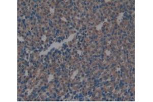 Detection of ARG in Rat Kidney Tissue using Monoclonal Antibody to Arginase (ARG) (ARG 抗体  (AA 1-323))