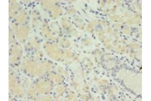 Immunohistochemistry (IHC) image for anti-MIS12, MIND Kinetochore Complex Component, Homolog (MIS12) (AA 1-305) antibody (ABIN7165811)