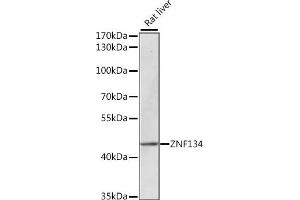 Western blot analysis of extracts of rat liver, using ZNF134 antibody (ABIN7271455) at 1:1000 dilution. (ZNF134 抗体  (AA 100-180))