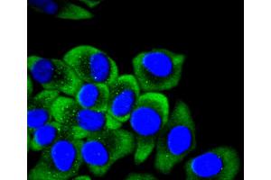 HepG2 cells were fixed in paraformaldehyde, permeabilized with 0. (KRT14 抗体)