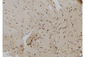 ABIN6260798 and ABIN6279296 at 1/100 staining Mouse liver tissue by IHC-P. (CHD8 抗体  (C-Term))
