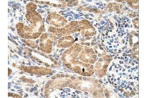 Image no. 1 for anti-GDP-Mannose Pyrophosphorylase B (GMPPB) (C-Term) antibody (ABIN321530) (GMPPB 抗体  (C-Term))