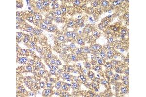 Immunohistochemistry of paraffin-embedded Rat liver using UGDH Polyclonal Antibody at dilution of 1:100 (40x lens). (UGDH 抗体)