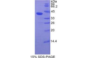 SDS-PAGE analysis of Human BMP10 Protein. (BMP10 蛋白)