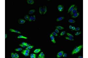 Immunofluorescent analysis of HepG2 cells using ABIN7173151 at dilution of 1:100 and Alexa Fluor 488-congugated AffiniPure Goat Anti-Rabbit IgG(H+L) (TMEM217 抗体  (AA 150-211))