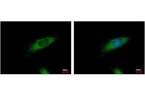 Image no. 3 for anti-Huntingtin Interacting Protein 1 Related (HIP1R) (N-Term) antibody (ABIN1494032) (HIP1R 抗体  (N-Term))