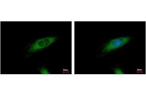 Image no. 3 for anti-Huntingtin Interacting Protein 1 Related (HIP1R) (N-Term) antibody (ABIN1494032) (HIP1R 抗体  (N-Term))