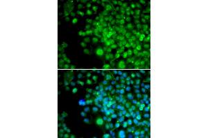 Immunofluorescence analysis of HeLa cells using FHL1 antibody. (FHL1 抗体)