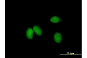 Immunofluorescence of purified MaxPab antibody to KCTD18 on HeLa cell. (KCTD18 抗体  (AA 1-426))
