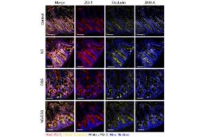 Lactobacillus johnsonii N5 improves the intestinal barrier tight junction protein and HSP70 expressions in dextran sulfate sodium-induced colitis. (TJP1 抗体)