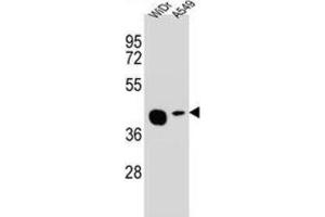 Western Blotting (WB) image for anti-Solute Carrier Family 35, Member G5 (SLC35G5) antibody (ABIN2995904) (AMAC1L2 抗体)