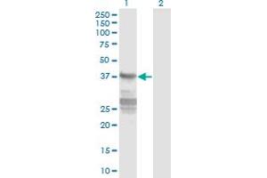 Western Blot analysis of CNN3 expression in transfected 293T cell line by CNN3 monoclonal antibody (M01), clone 4C4. (CNN3 抗体  (AA 1-329))