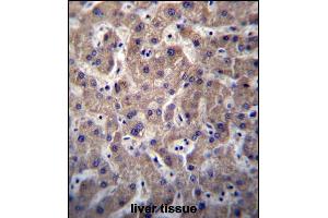 SULT1A3/SULT1A4 Antibody (N-term) (ABIN656776 and ABIN2845995) immunohistochemistry analysis in formalin fixed and paraffin embedded human liver tissue followed by peroxidase conjugation of the secondary antibody and DAB staining. (SULT1A3,SULT1A4 (AA 71-99), (N-Term) 抗体)