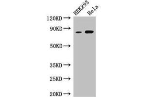 Western Blot Positive WB detected in: HEK293 whole cell lysate, Hela whole cell lysate All lanes: MELTF antibody at 3 μg/mL Secondary Goat polyclonal to rabbit IgG at 1/50000 dilution Predicted band size: 81, 33 kDa Observed band size: 81 kDa (MFI2 抗体  (AA 20-302))