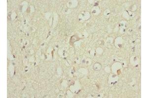Immunohistochemistry of paraffin-embedded human brain tissue using ABIN7176117 at dilution of 1:100 (ZNF148 抗体  (AA 690-794))