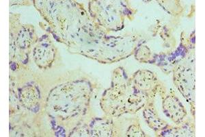 Immunohistochemistry of paraffin-embedded human placenta tissue using ABIN7145108 at dilution of 1:100 (ATG16L1 抗体  (AA 90-300))