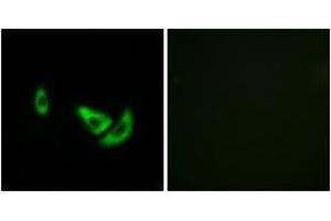 Immunofluorescence analysis of A549 cells, using DCT Antibody. (DCT 抗体  (AA 51-100))