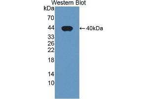 Detection of Recombinant PDE1A, Human using Polyclonal Antibody to Phosphodiesterase 1A, Calmodulin Dependent (PDE1A) (PDE1A 抗体  (AA 2-318))