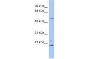 Image no. 1 for anti-Retinoblastoma Binding Protein 9 (RBBP9) (N-Term) antibody (ABIN6742511) (RBBP9 抗体  (N-Term))