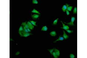 Immunofluorescence staining of MCF-7 cells with ABIN7162048 at 1:330, counter-stained with DAPI. (NME1 抗体  (AA 2-152))