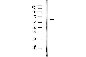 anti-Docking Protein 7 (DOK7) (C-Term) antibody