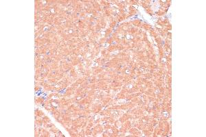 Immunohistochemistry (IHC) image for anti-Calcium Channel, Voltage-Dependent, beta 2 Subunit (CACNB2) (AA 481-660) antibody (ABIN7266010)