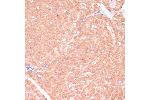 Immunohistochemistry of paraffin-embedded mouse heart using C antibody (ABIN7266010) at dilution of 1:100 (40x lens). (CACNB2 抗体  (AA 481-660))