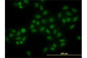 Immunofluorescence of monoclonal antibody to HMGB1 on HeLa cell. (HMGB1 抗体  (AA 1-90))