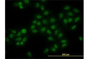 Immunofluorescence of monoclonal antibody to HMGB1 on HeLa cell.
