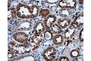Immunohistochemical staining of paraffin-embedded Carcinoma of thyroid tissue using anti-RC219453 mouse monoclonal antibody. (NPR3 抗体)