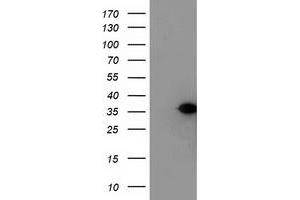 Western Blotting (WB) image for anti-Nucleotide Binding Protein-Like (NUBPL) (AA 1-250) antibody (ABIN1490634) (NUBPL 抗体  (AA 1-250))