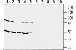 Western blot analysis of human U-87 MG glioblastoma cell line lysate (lanes 1 and 6), human THP-1 monocytic leukemia cell line lysate (lanes 2 and 7), human SH-SY5Y neuroblastoma cell line lysate (lanes 3 and 8), human MEG-01 megakaryoblastic leukemia cell line lysate (lanes 4 and 9) and human Jurkat T-cell leukemia cell line lysate (lanes 5 and 10): - 1-5. (SLC2A3 抗体  (1st Extracellular Loop))