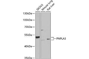 Western blot analysis of extracts of various cell lines, using PNPL Antibody (ABIN6132501, ABIN6145859, ABIN6145860 and ABIN6222404) at 1:1000 dilution. (PNPLA3 抗体  (AA 377-481))