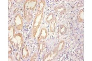 Immunohistochemistry of paraffin-embedded human kidney tissue using ABIN7159509 at dilution of 1:100 (MT1A 抗体  (AA 1-59))