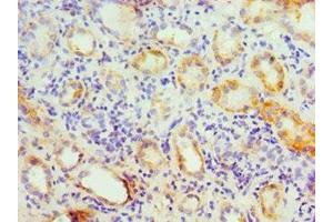 Immunohistochemistry of paraffin-embedded human kidney tissue using ABIN7154176 at dilution of 1:100 (GATM 抗体  (AA 124-423))