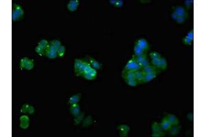 Immunofluorescence (IF) image for anti-ATPase, Ca++ Transporting, Cardiac Muscle, Fast Twitch 1 (ATP2A1) (AA 384-579) antibody (ABIN7168596)
