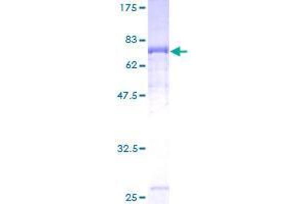 TYW1 Protein (AA 1-384) (GST tag)