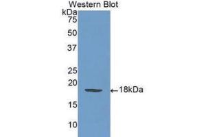 Western Blotting (WB) image for anti-Selectin P (Granule Membrane Protein 140kDa, Antigen CD62) (SELP) (AA 58-195) antibody (ABIN1078521) (P-Selectin 抗体  (AA 58-195))