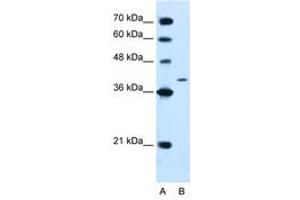 Image no. 1 for anti-Protein tyrosine Phosphatase, Non-Receptor Type 2 (PTPN2) (AA 23-72) antibody (ABIN205078) (PTPN2 抗体  (AA 23-72))