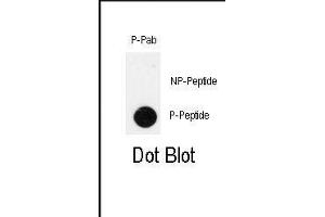 Image no. 1 for anti-Pancreatic and Duodenal Homeobox 1 (PDX1) (pThr11) antibody (ABIN358543) (PDX1 抗体  (pThr11))