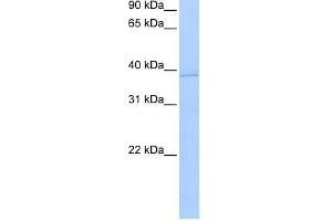 Human MCF-7; WB Suggested Anti-ANXA8L2 Antibody Titration: 0. (ANXA8L2 抗体  (N-Term))
