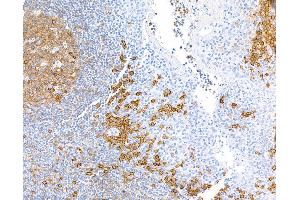 Immunohistochemistry (IHC) image for anti-CD38 (AA 43-300) antibody (ABIN7453961) (Recombinant CD38 抗体  (AA 43-300))