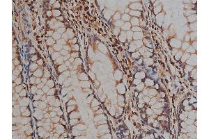 ABIN6268881 at 1/200 staining human colon tissue sections by IHC-P.
