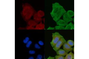 staining Hela cells(30 min of UV treatment) by IF/ICC. (PDE4B/C/D 抗体)