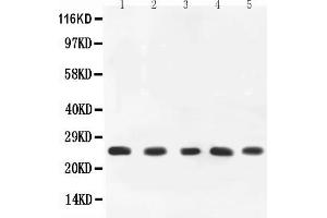 Anti-TNF alpha Picoband antibody, All lanes: Anti-TNF alpha at 0. (TNF alpha 抗体  (AA 89-235))